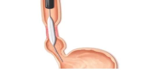 Endoscopia Gastrointestinal Leon Gto