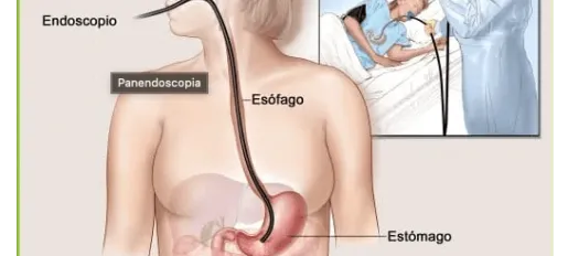 Endoscopia Gastrointestinal Leon Gto