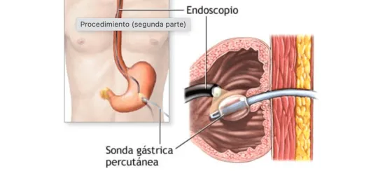 Endoscopia Gastrointestinal Leon Gto