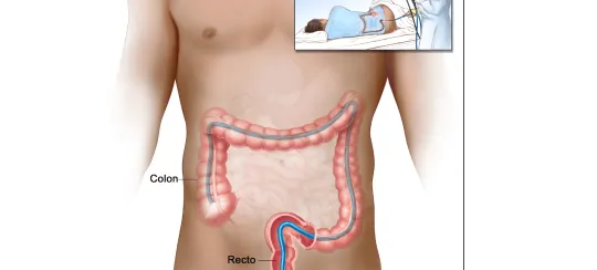 Endoscopia Gastrointestinal Leon Gto