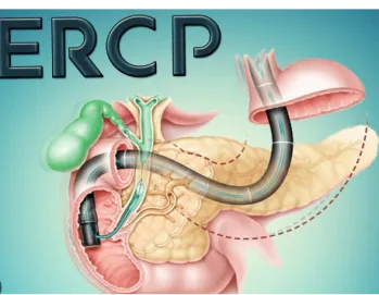 Endoscopia Gastrointestinal Leon Gto
