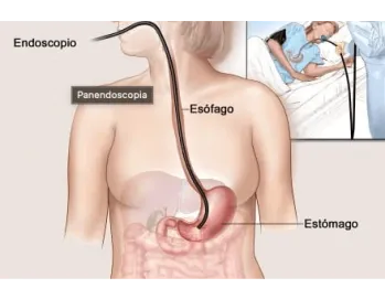 Endoscopia Gastrointestinal Leon Gto